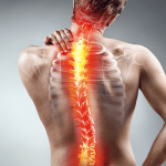 man with scoliosis clutches upper back