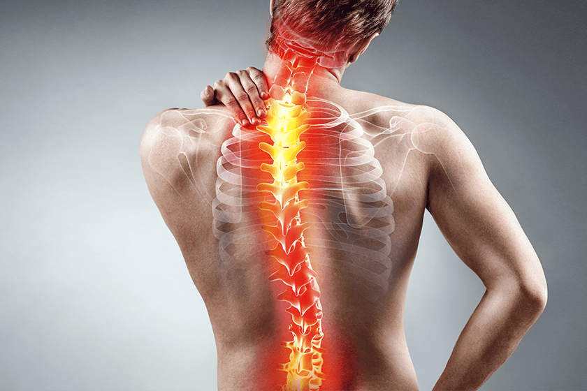 man with scoliosis clutches upper back