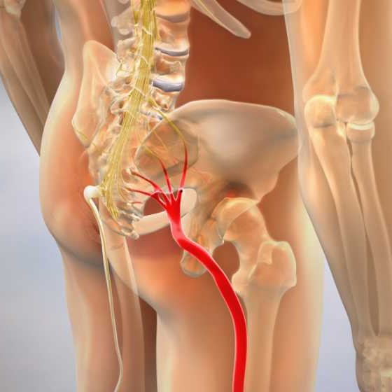 Person doing a gentle stretch to help relieve sciatica-related leg pain