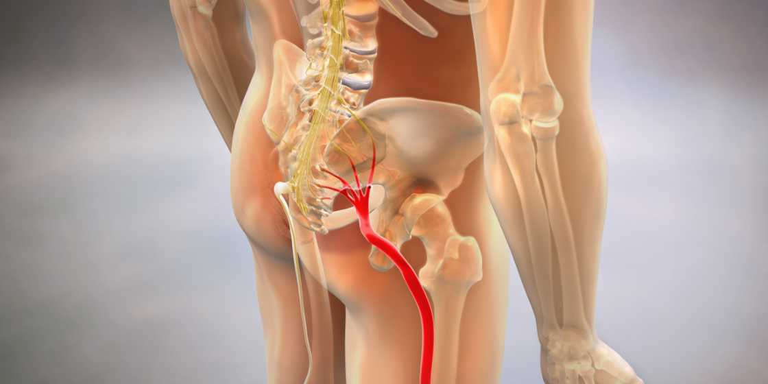 Severe Sciatic Nerve Leg Pain Relief – Best Pain Relief for