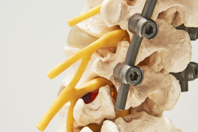 spine model with pedicle screws