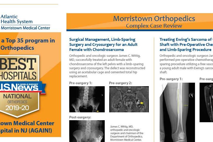 morristown medical center complex case review