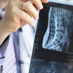 ortho vs neuro surgeon selection