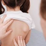 pediatric candidate for scoliosis back brace