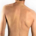 scoliosis in adults symptoms