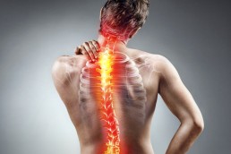 man holding his back with scoliosis of the spine showing in x-ray overlay