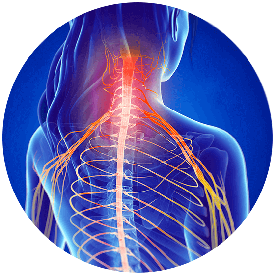 buffet Fremmedgøre vejkryds Pinched Nerve | Symptoms & Advanced Spine Care