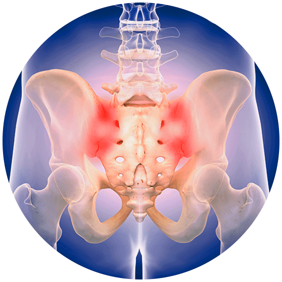 Sacroiliac Joint Pain | Symptoms & Advanced Care