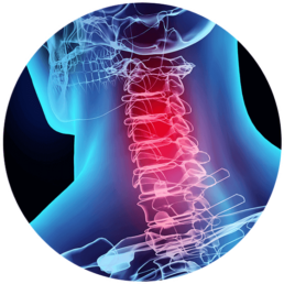 Whiplash | Symptoms & Advanced Spine Care