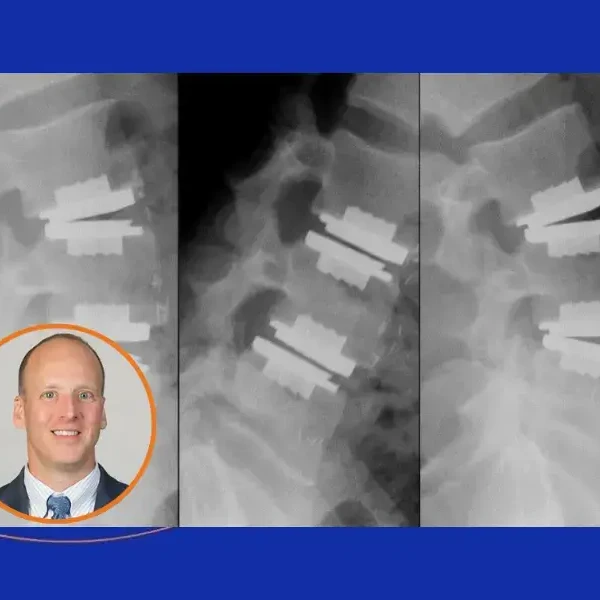 Dr. George Naseef Sets the Standard for Motion Preservation Spine Care in New Jersey